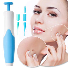Skin Tag Remover Kit with interchangeable tips