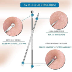 4 different needle tips for various blemish removal