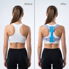 spine alignment correction brace